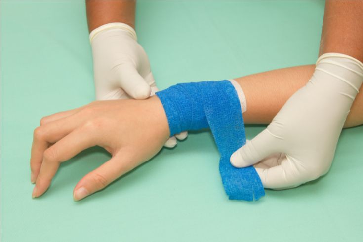 A partir de cuantos puntos de sutura es delito